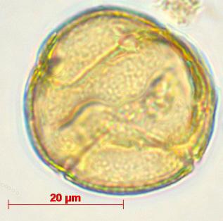 Rumex arcticus; both tricolporate grains (14) and tetracolporate
