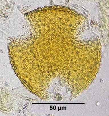 17 Pollen grain of Valeriana capitata; the echinae are often