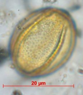 18 Unidentified 3-colpate pollen type with a scabrate wall structure; from ice-wedge polygon mire Lc04 near Chokurdakh,