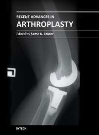 Recent Advances in Arthroplasty Edited by Dr.