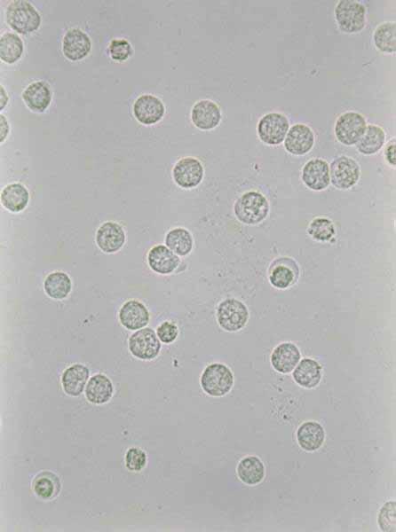 Leukocyte (White blood cell) Increased leukocyte Granular spheres, diameter ~ 12 micron,