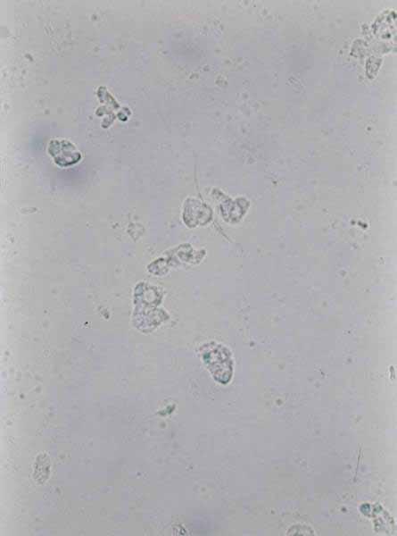 Renal tubular cell Line the tubule Slightly larger than leukocyte Round or
