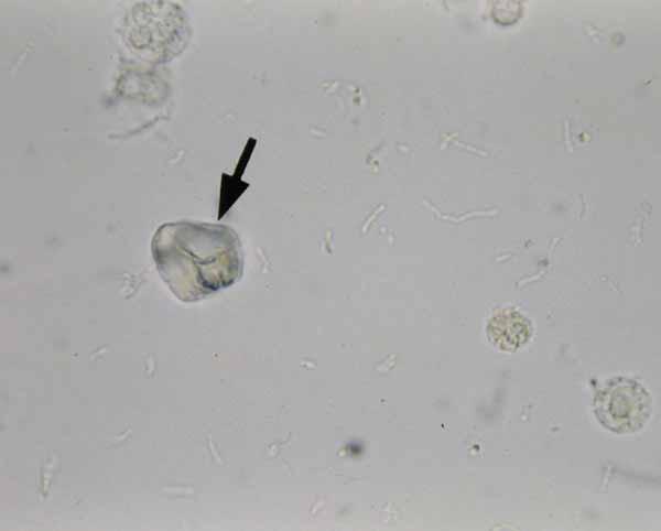 Spermatozoa