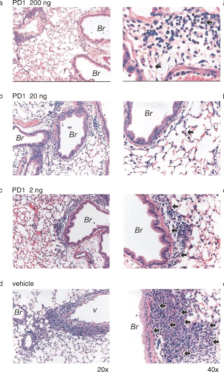 Bioactivity of Protectin D1 in the airways OVA-sensitized/challenged mice Protectin D1 suppresses eosinophil accumulation