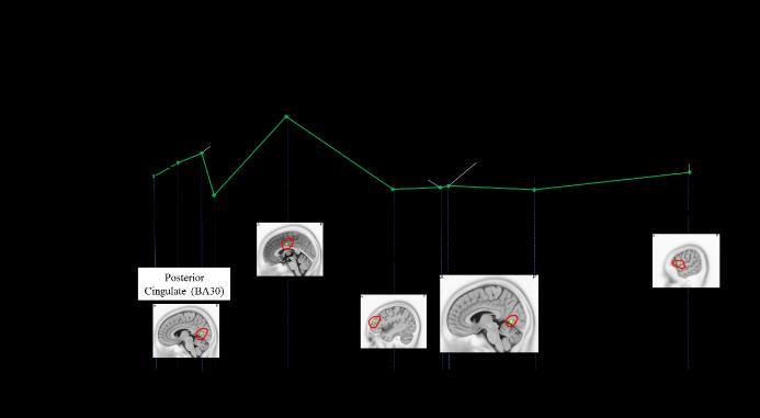 6 Graph of empathetic-pain perception formation with the source location of the highest empathetic-pain perception intensity for LH at The formation of empathetic-pain perception as induced by LL,