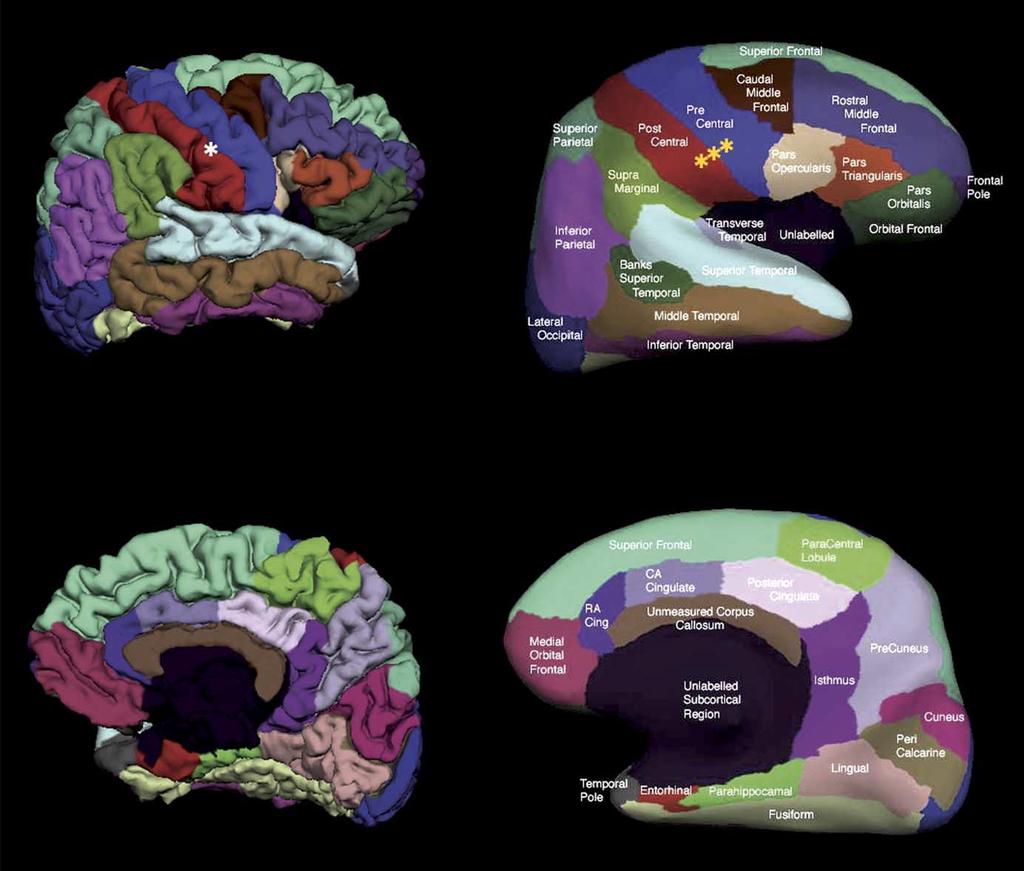 4 R.S. Desikan et al. / NeuroImage xx (2006) xxx xxx Fig. 1. Pial (left) and inflated (right) cortical representations of the regions of interest in one hemisphere.