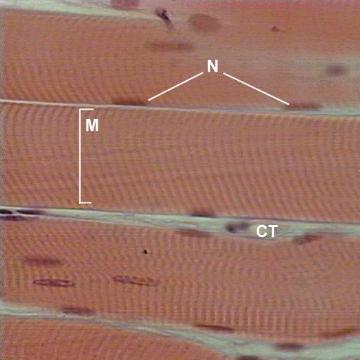 Background Overview of Skeletal Muscle Contraction Sarcomere Thick Filaments Skeletal muscle fibers are very large, elongated cells (Fig 9.1).