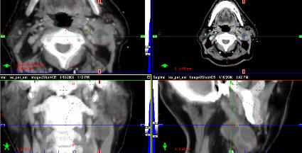 to Sim-CT Imaging for