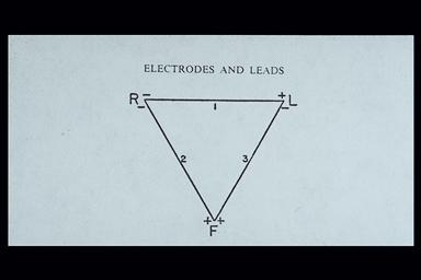 ECG leads Limb leads signify the direction of electricity longitudinally in the body Precordial (chest) leads