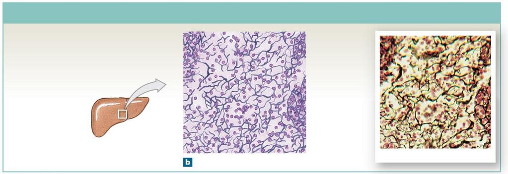 Figure 4-10b Adipose and Reticular Tissues Reticular Reticular Tissue LOCATIONS: Liver, kidney, spleen, lymph nodes, and