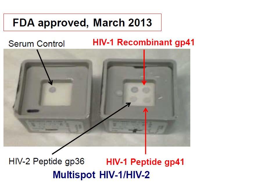 HIV-1/HIV-2 Differentiation Assay Image courtesy of the CDC from