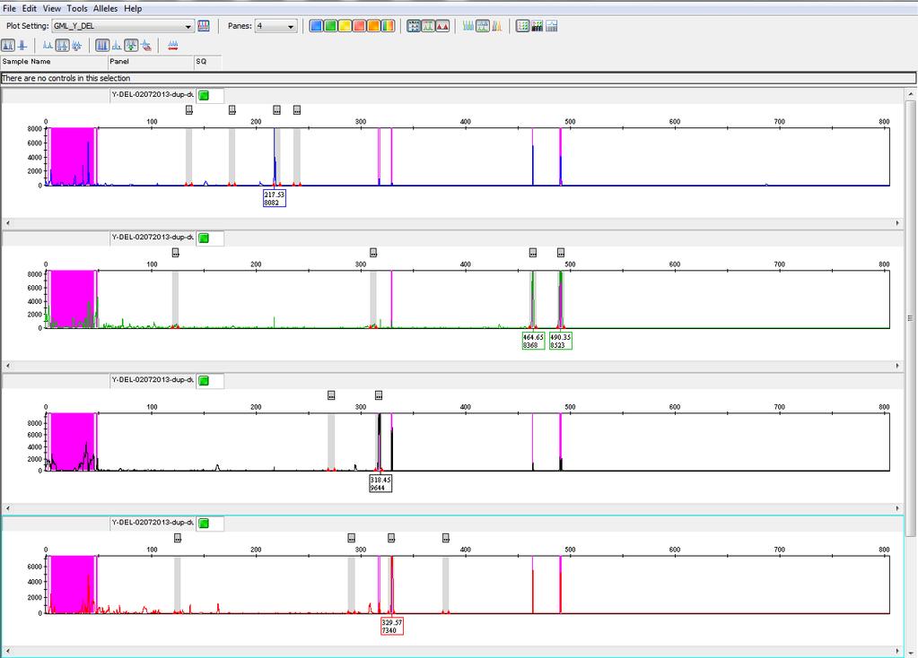 Sample DNAs with Microdeletions on Y Chromosome Sample DNA (40 ng/µl) with multiple deleted markers Y152, Y153, Y133, Y134, RBMY, Y255, Y127, Y157, and Y254 is demonstrated in