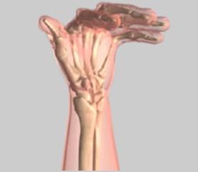 Unit 3: Biomechanics of the Hand Normal Movement Biomechanics is a term to describe movement of the body.