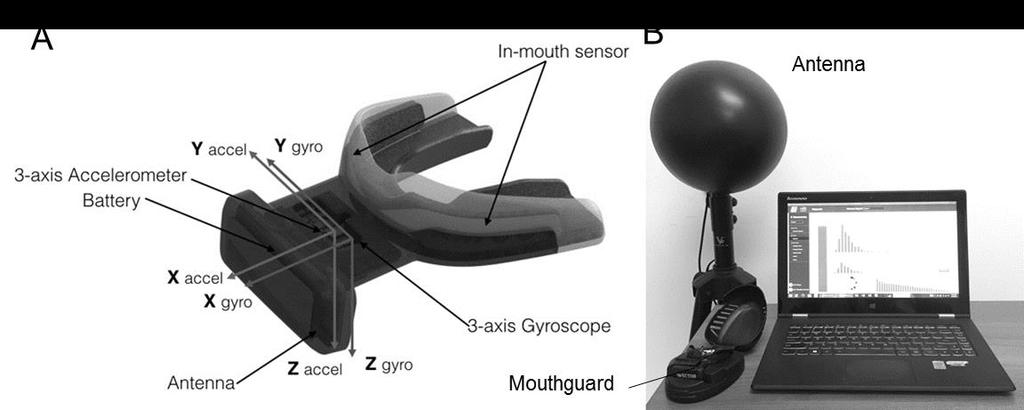 Head impact kinematic measurements using mouth guard and sideline monitoring system A, triaxial accelerometer senses linear acceleration and triaxial gyroscope senses angular acceleration (i1