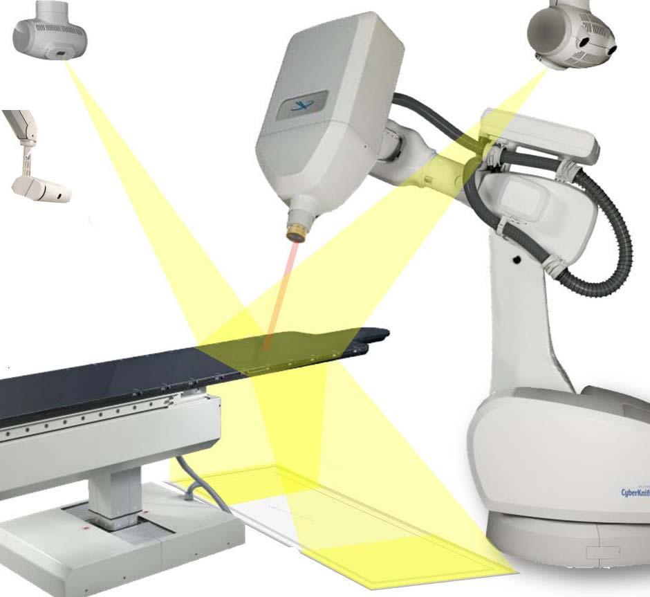 CyberKnife First clinical system designed to detect and compensate for intrafx motion.