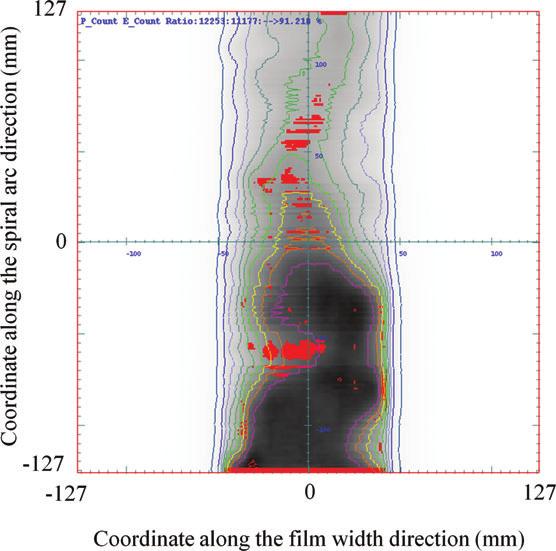 A comparison of isodose contours between calculated (solid line) and measured (dotted line) dose distributions with an isocontour step size of 10%, for the single field plan shown in Fig. 4.