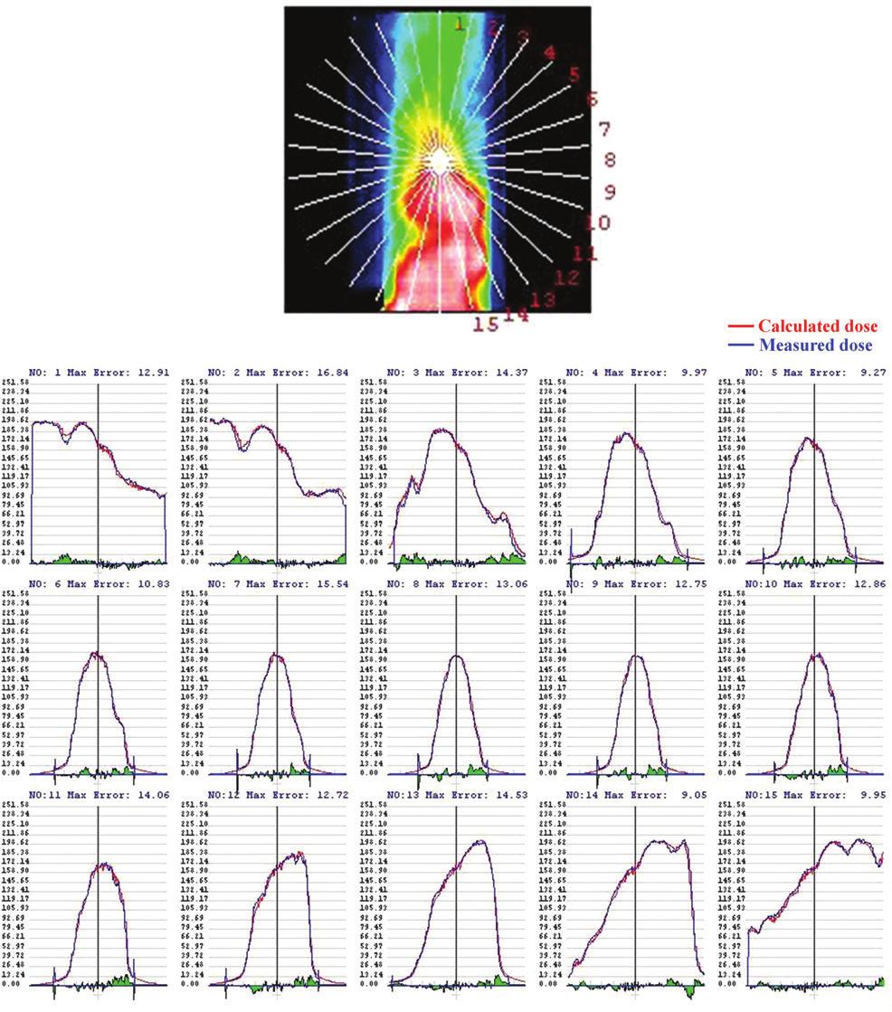 1158 M. Tanooka et al. Fig. 8. Comparisons between calculated (red line) and measured (blue line) radial dose profiles at 12 intervals for the VMAT plan with the origin at the film center.