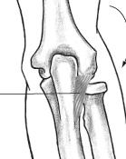 org/afp/20000201/691.html Evaluation of Overuse Elbow Injuries Medical Multimedia Group www.healthpages.