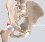 1 to 4) The socket (acetabulum) is situated on the