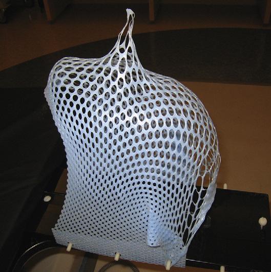 Cyberknife Radiotherapy for Vestibular Schwannoma 667 Fig. 2. A custom-fit Aquaplast mask is shown attached to the treatment table.