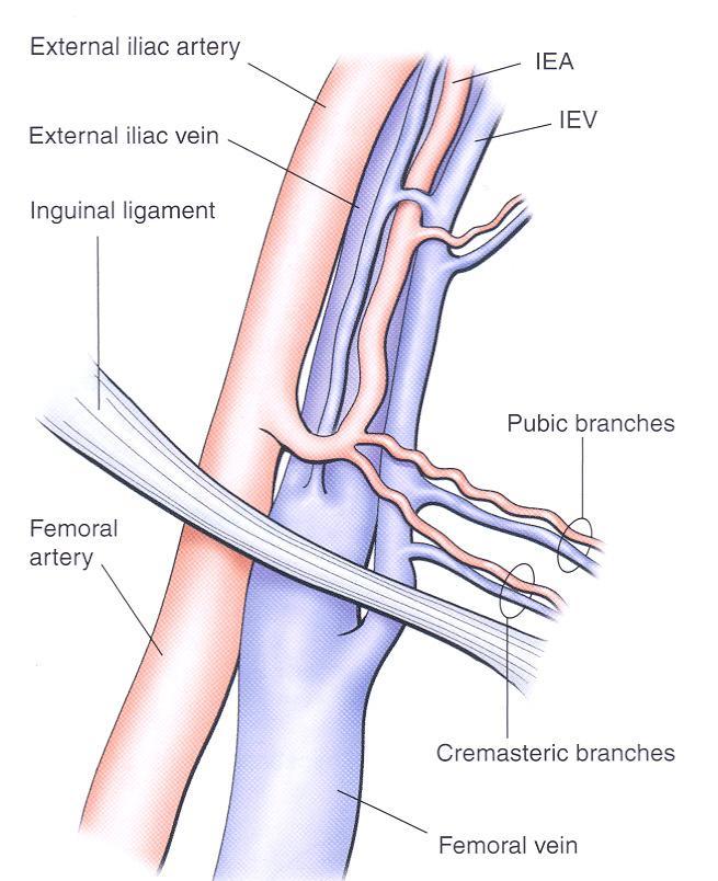 of this artery is not sufficient for an independent graft. It is used as a composite graft with the LIMA as extension graft. You are familiar with this artery regarding anatomy of inguinal triangle.