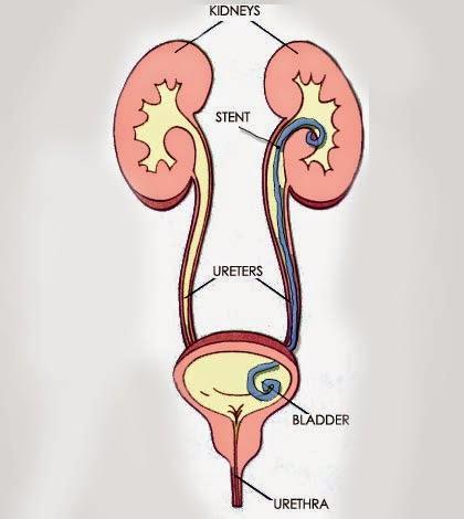 MEDICAL TREATMENT A lot of time was spent waiting for return of renal function so that an arteriogram could be done