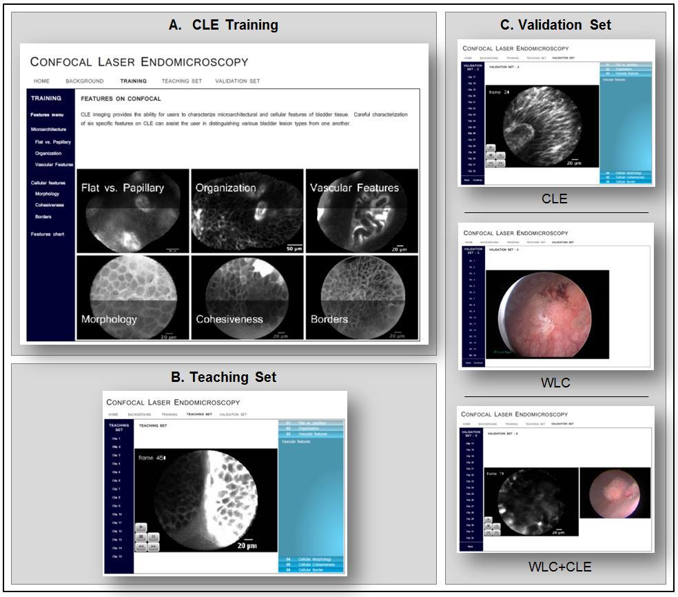 Page 19 of 20 19 FIG 1. Computer-based, interactive training modules for confocal laser endomicroscopy of the bladder. (A) CLE Training: Observers were trained to identify six key CLE features.