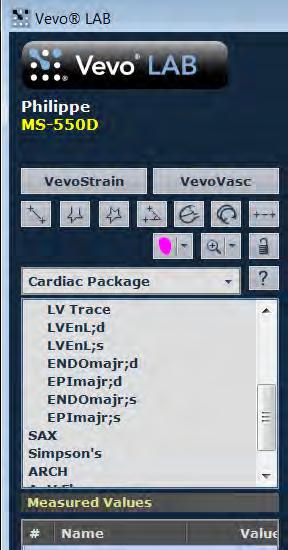 Systolic Function Measurement with ENDOmajr/area Workflow 1) Select Cardiac Package 2)