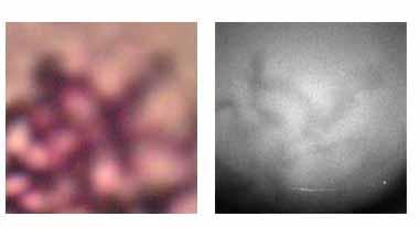 2 Light and X-ray microscopic images of a NIH3T3 cell at  It