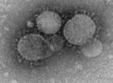 Middle East Respiratory Syndrome Coronavirus (MERS-CoV) New virus emerged Spring 2012 as a cause of SARI/ARDS in humans.