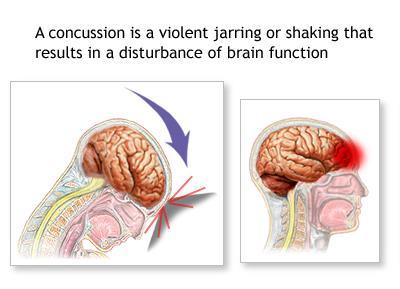 Nervous System Health Concerns Nervous System Health Concerns Concussion A temporary disturbance of the brain s ability to function due to a hard blow to the head