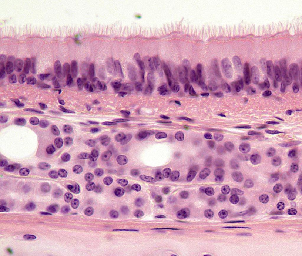 Pseudostratified epithelium (trachea) Cilia