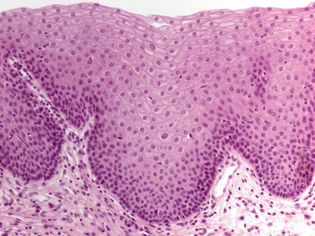 Stratified squamous epithelium (esophagus)