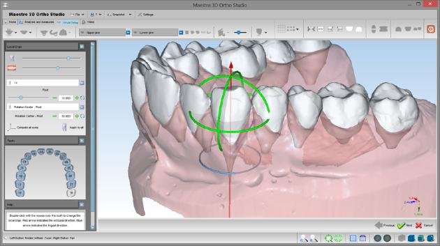Maestro Dental Studio The gold standard for Automated Orthodontic Invisible Aligner