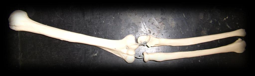 Station 10 29. Which arm is this, left or right? (Hint: Consult your laboratory skeleton) 30. What is the name of the bone that is thickest at the wrist?
