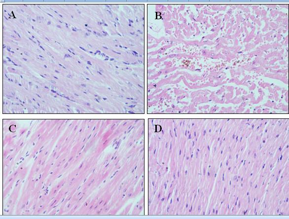 Assessment of histopathological cardiac damage (A) Control group: Normal heart architecture was observed (B)