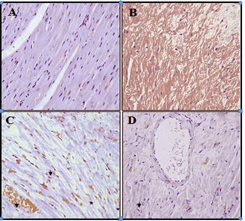 Immunohistochemical examinations Effects of doxorubicin (DOX) with/without sitagliptin pretreatment on the expression of nuclear factor kappa B (NF-κB) by immunohistochemical staining.