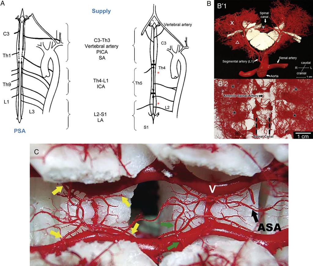 C.D. Etz et al. / European Journal of Cardio-Thoracic Surgery 949 Figure 2: (A) Blood supply to the spinal cord.