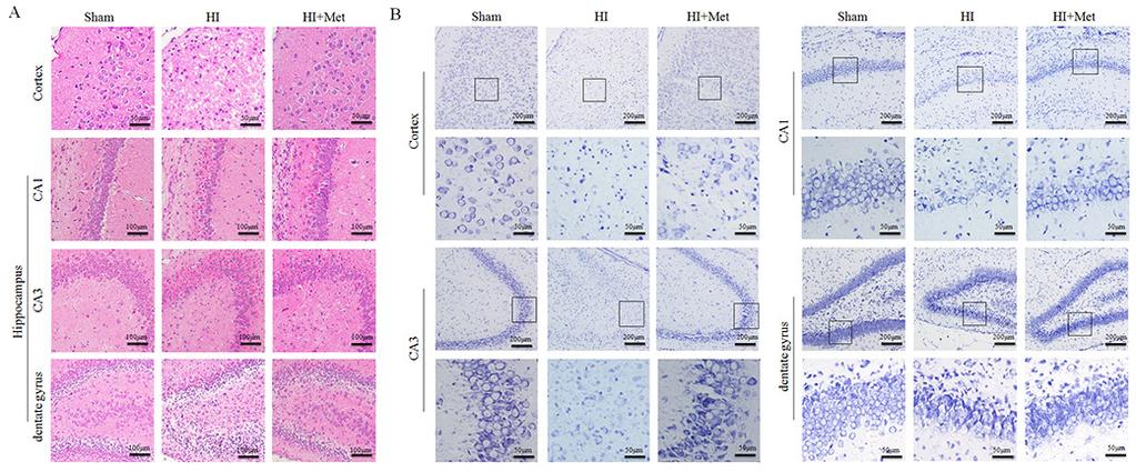 promoted remyelination and axonal reparation in the neonatal rats following HI.