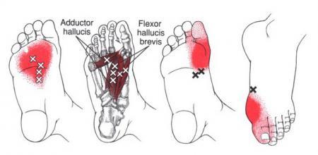 Foot Intrinsic Muscles Function: these are the muscles inside the foot, in contrast to extrinsic foot muscles that move the foot and toes, but whose muscle bellies are external to the foot (i.e., in the calf or shin).