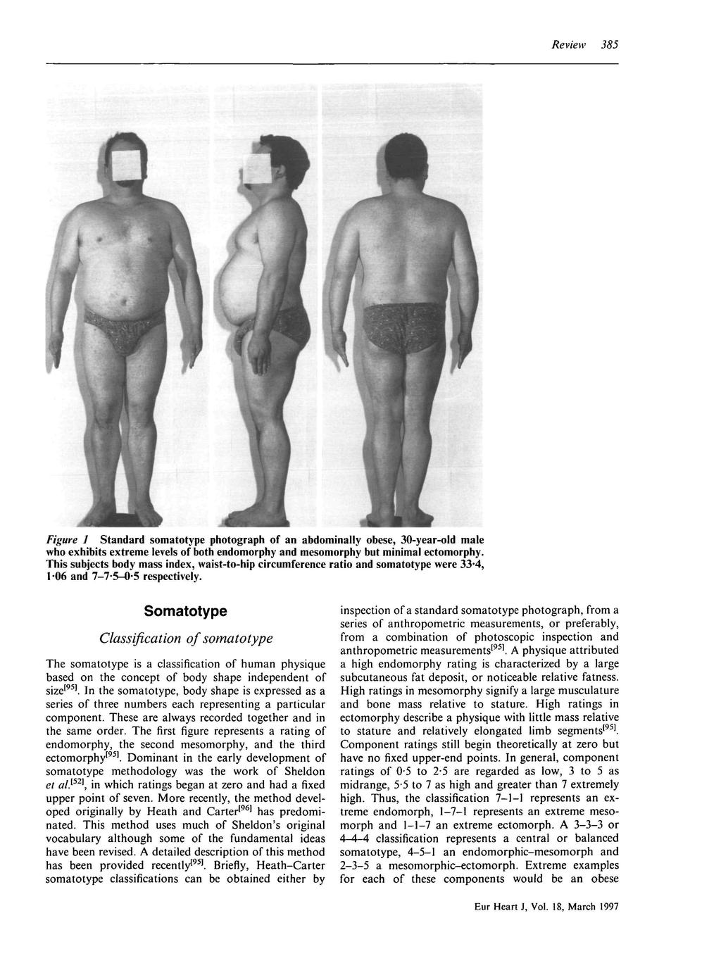 Review 385 Figure 1 Standard somatotype photograph of an abdominally obese, 30-year-old male who exhibits extreme levels of both endomorphy and mesomorphy but minimal ectomorphy.