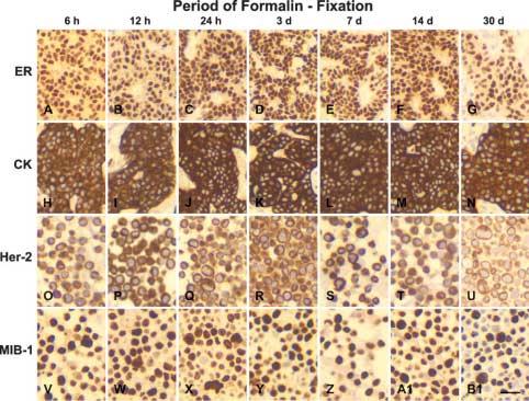 Standardization of IHC 107 ranging from 6 hr to 30 days, although the immunostaining intensity of 30-day fixed FFPE tissue sections for Her-2/neu and ER was slightly weaker than that obtained in FFPE