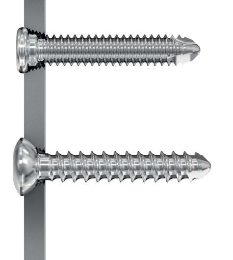 Fully threaded, therefore not intended to generate interfragmentary compression Same thread as a variable angle locking screw or locking screw Can be replaced with a locking screw after