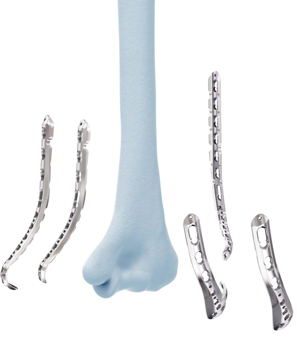 VA-LCP Distal Humerus Plates The plates offer multiple screw configurations for the medial and lateral columns, and the