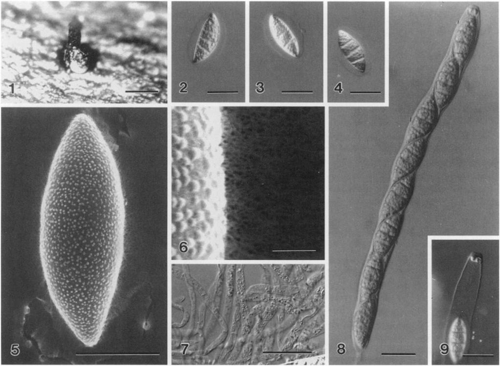 3. Ascospores with acute ends... 4 4. Ascospores 35-37.5 X 12.5-15, ellipsoidal, with a thick mucilaginous sheath 6-8 pm wide... A.hungkongensis 4.