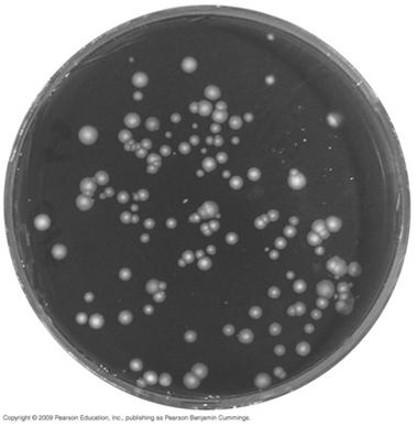 Legionnaires Disease Typical pneumonia symptoms and possible complications of the gastrointestinal tract, CNS, liver, and kidneys Pathogen and virulence factors Caused by Legionella pneumophila