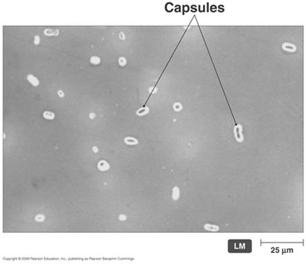 Klebsiella pneumoniae capsule 25 Other Bacterial Pneumias Cause Haemophilus influenzae, Staphylococcus aureus, Yersinia pestis, and Chlamydia