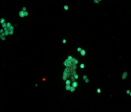 Annexin v-cy3 under the florescent microscope. (A) control.