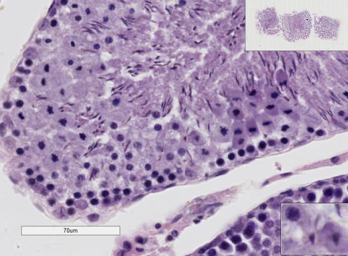 Slide #101 (1096). Testis, rat. seminiferous tubule spermatids Meiotic figures (metaphase plates) Primary S. Secondary S.