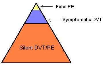 Epidemiology The majority of VTE events is asymptomatic; while some cases present with